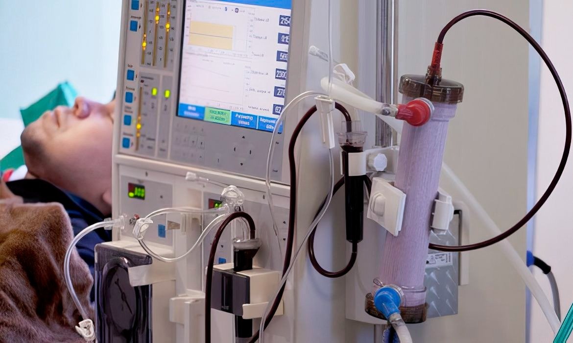Mais de 170 mil brasileiros dependem de terapia renal