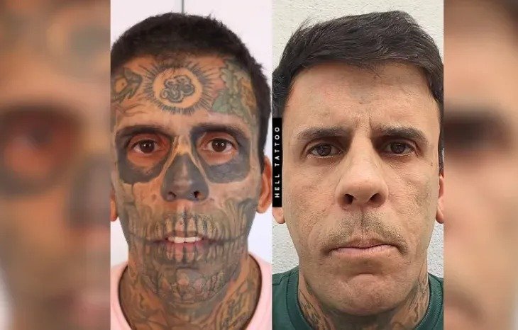 Ultrassom Revela Tumor de 6 cm na Bexiga de Leandro de Souza